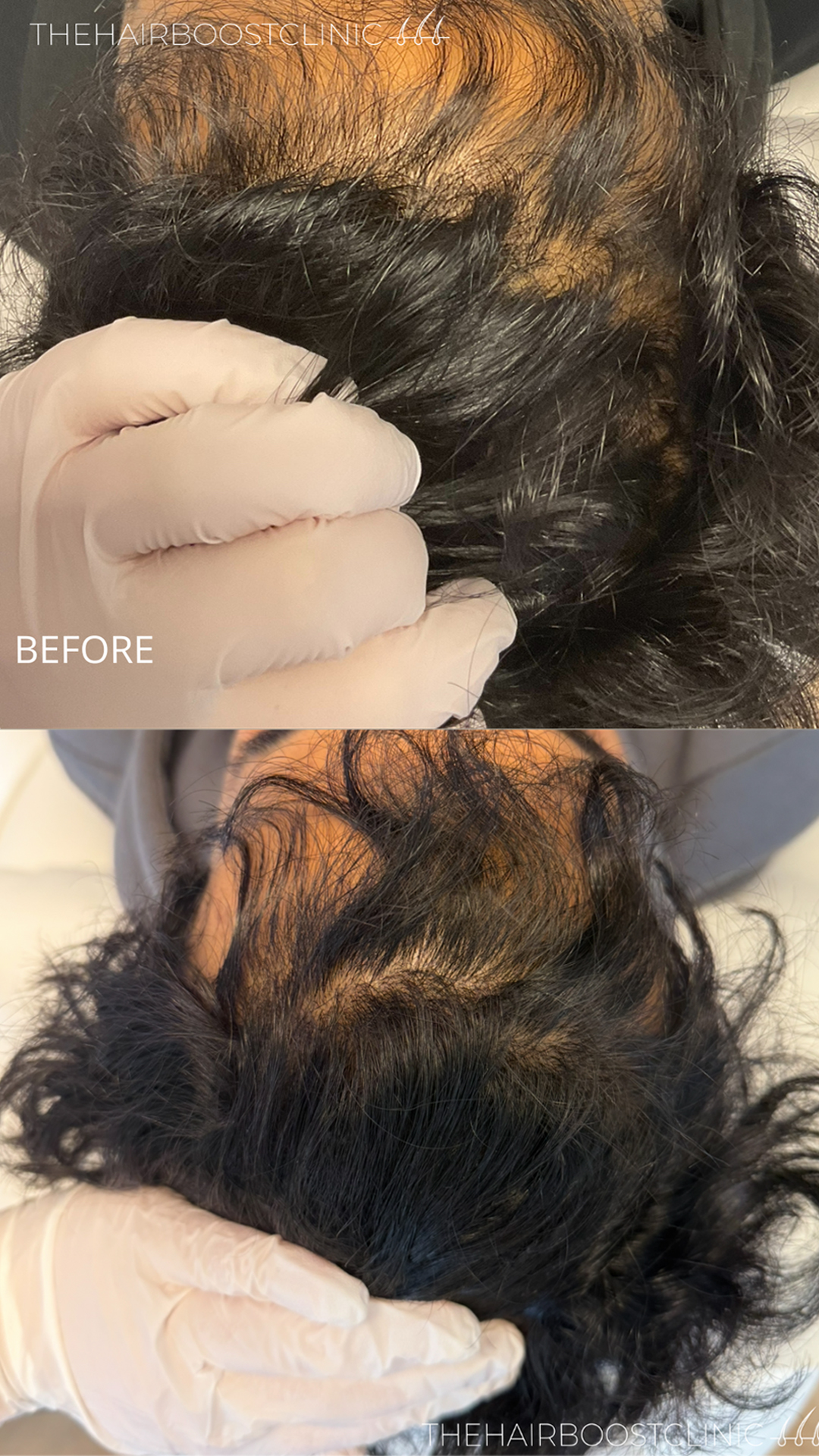 The-Hairboost-Clinic-19 updated 2